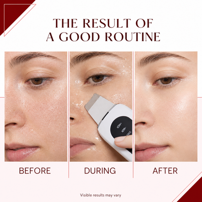 GlowSonic Cleanser – before, during and after facial cleansing routine | Glow Vanta